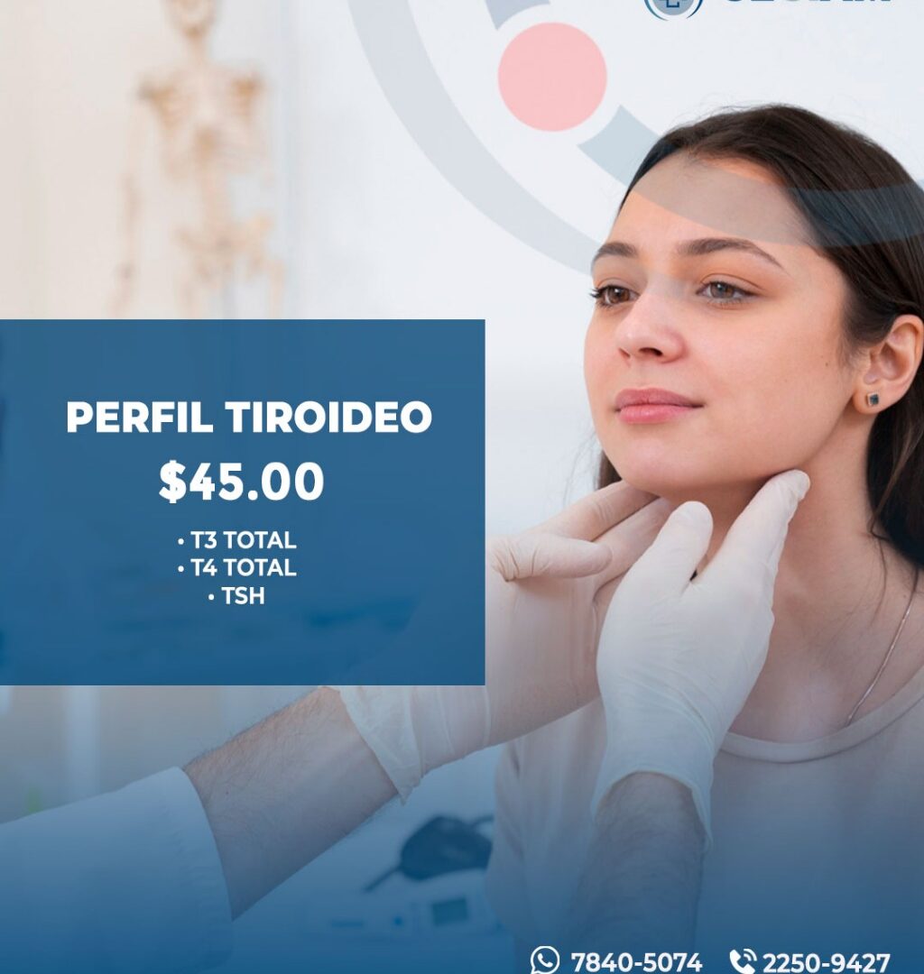 Perfil Tiroideo