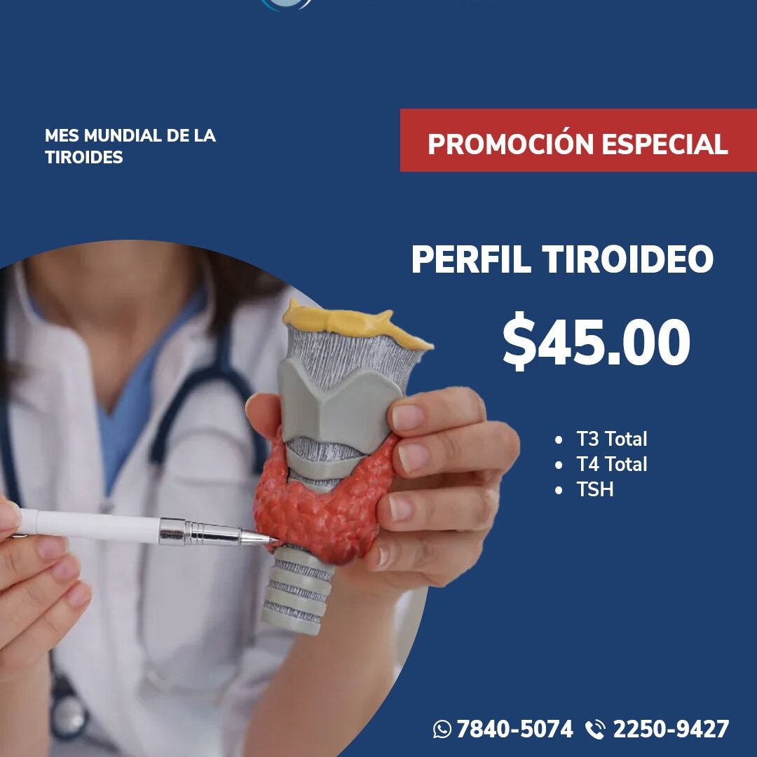 Perfil Tiroideo