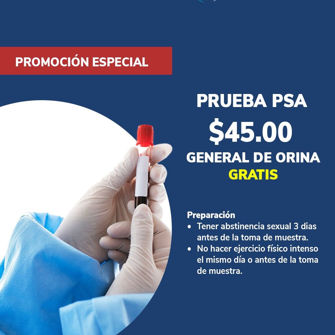 Prueba PSA